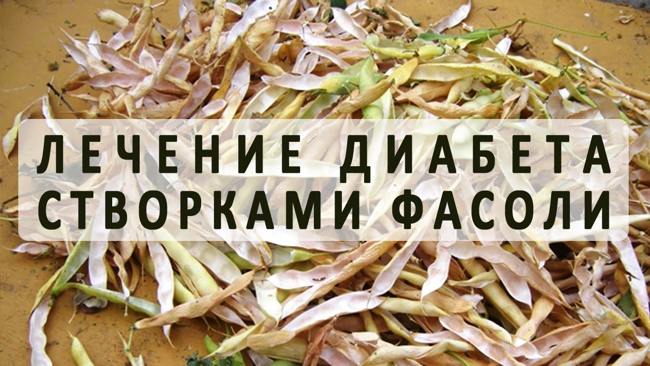 Сыр при диабете: какие сорта можно кушать? | компетентно о здоровье на ilive